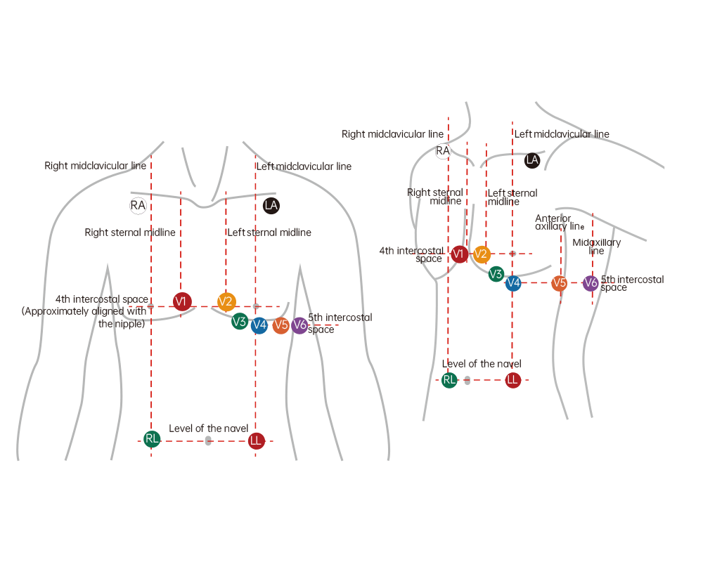 FAQ12Lead ECG Monitor MDcubes